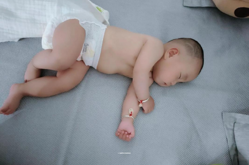 浮梁六个月宝宝眼睛散光